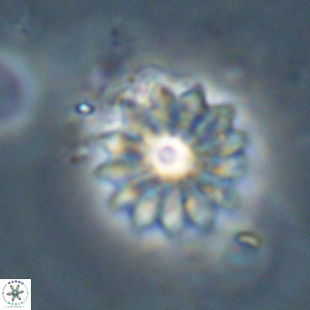Discoaster salisburgensis VR 29197