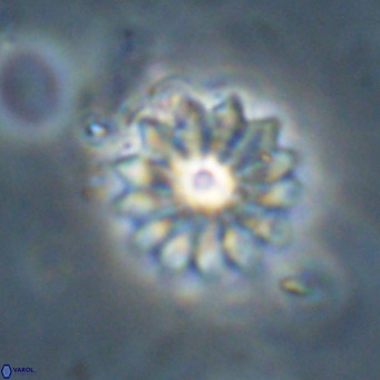 Discoaster salisburgensis VR 29198