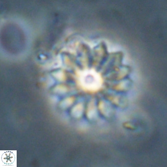 Discoaster salisburgensis VR 29198