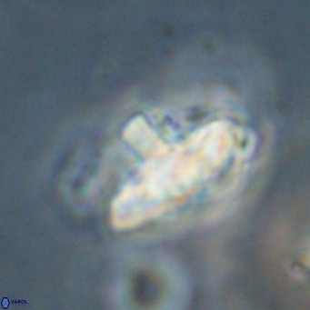 Discoaster salisburgensis VR 29199