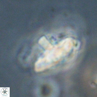 Discoaster salisburgensis VR 29199