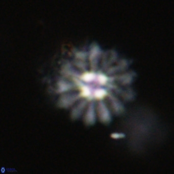 Discoaster salisburgensis VR 29190