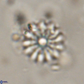 Discoaster salisburgensis VR 29192