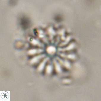 Discoaster salisburgensis VR 29192
