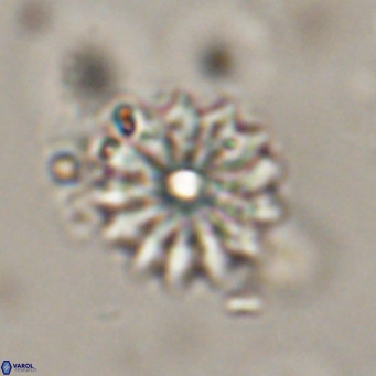 Discoaster salisburgensis VR 29193