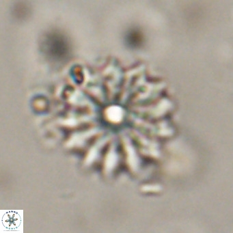 Discoaster salisburgensis VR 29193