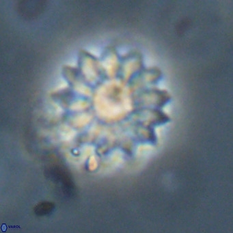 Discoaster salisburgensis VR 29204