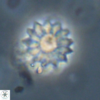 Discoaster salisburgensis VR 29204