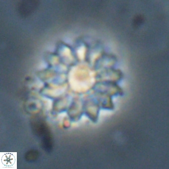 Discoaster salisburgensis VR 29205