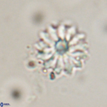 Discoaster salisburgensis VR 29206