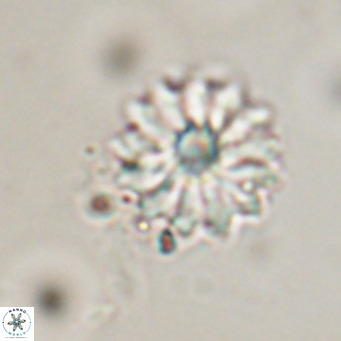 Discoaster salisburgensis VR 29206