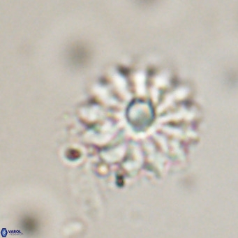 Discoaster salisburgensis VR 29207