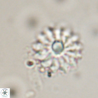 Discoaster salisburgensis VR 29207
