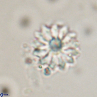 Discoaster salisburgensis VR 29208