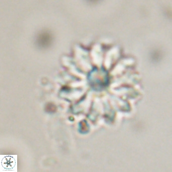Discoaster salisburgensis VR 29208