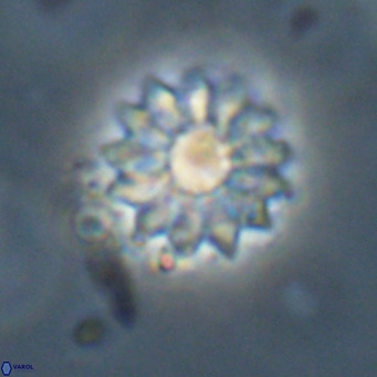 Discoaster salisburgensis VR 29202