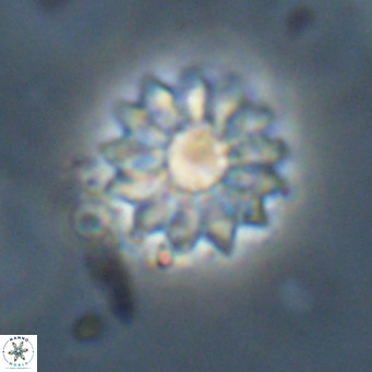 Discoaster salisburgensis VR 29202