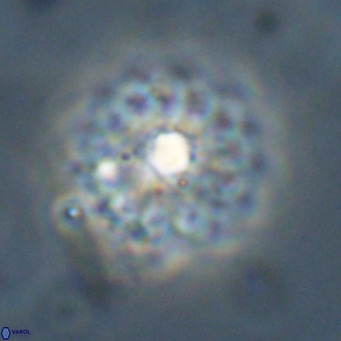 Discoaster salisburgensis VR 29203