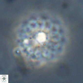 Discoaster salisburgensis VR 29203