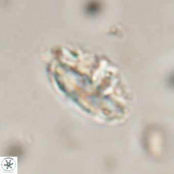 Discoaster salisburgensis VR 29214