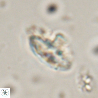 Discoaster salisburgensis VR 29215