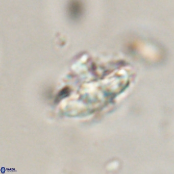 Discoaster salisburgensis VR 29210