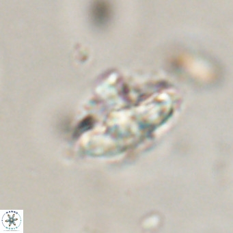 Discoaster salisburgensis VR 29210