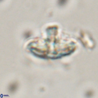 Discoaster salisburgensis VR 29211