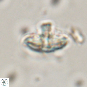 Discoaster salisburgensis VR 29211