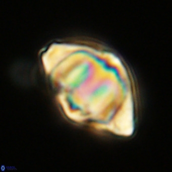 Discoaster sanmiguelensis VR 18506