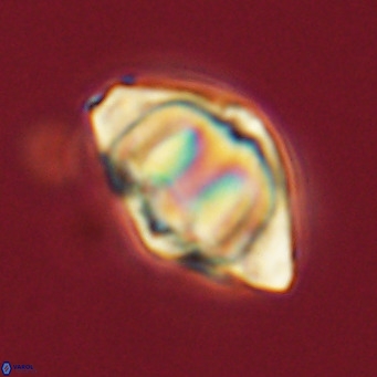 Discoaster sanmiguelensis VR 18507