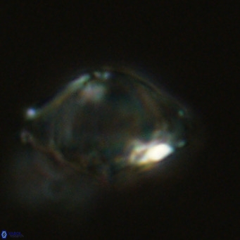 Discoaster sanmiguelensis VR 18509