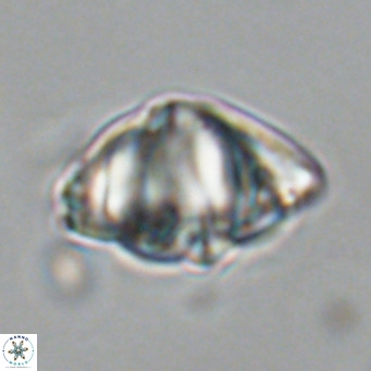 Discoaster sanmiguelensis VR 18502