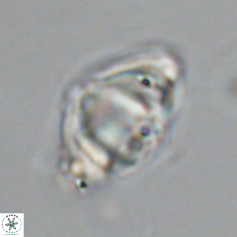 Discoaster sanmiguelensis VR 18503