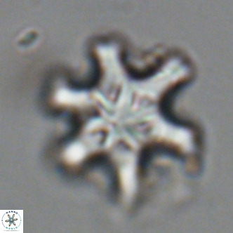 Discoaster sanmiguelensis VR 18515