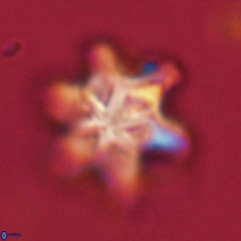 Discoaster sanmiguelensis VR 18516