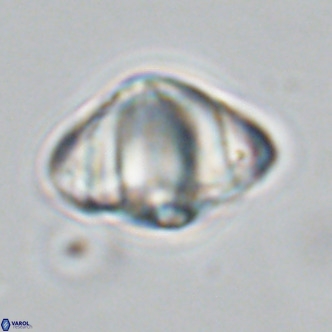 Discoaster sanmiguelensis VR 18510