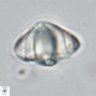 Discoaster sanmiguelensis VR 18510