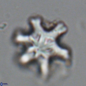 Discoaster sanmiguelensis VR 18511