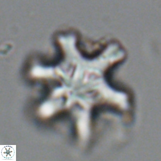 Discoaster sanmiguelensis VR 18511