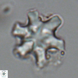 Discoaster sanmiguelensis VR 18513