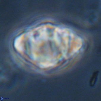 Discoaster sanmiguelensis VR 18524