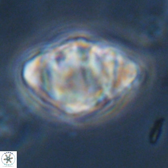Discoaster sanmiguelensis VR 18524