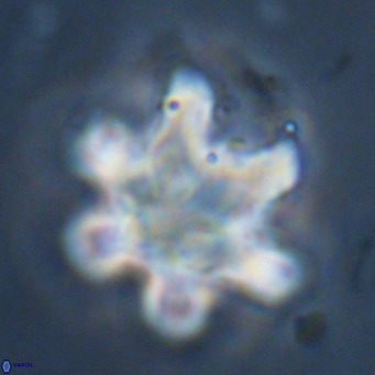 Discoaster sanmiguelensis VR 18526