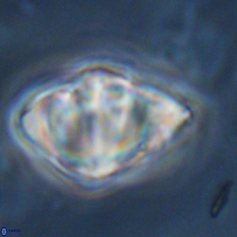 Discoaster sanmiguelensis VR 18521