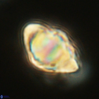 Discoaster sanmiguelensis VR 18534