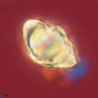 Discoaster sanmiguelensis VR 18535