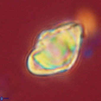 Discoaster sanmiguelensis VR 18536