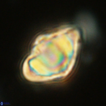 Discoaster sanmiguelensis VR 18537