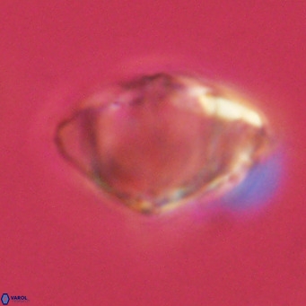 Discoaster sanmiguelensis VR 18532